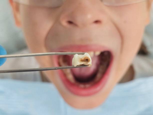  Gloster, MS Emergency Dentist Pros