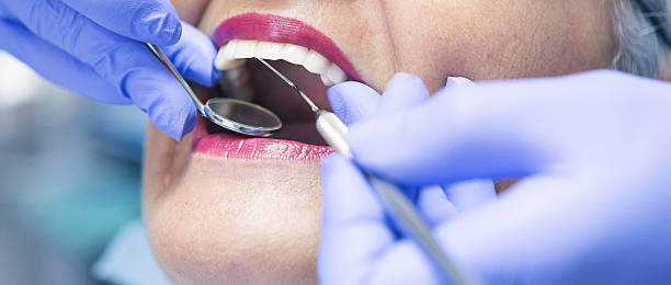 Best Emergency Root Canal Therapy in Gloster, MS